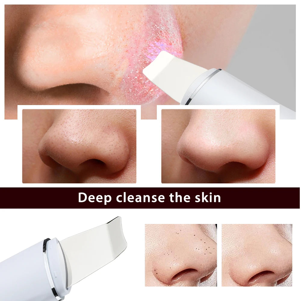 Ultrasonic Skin Scrubber & EMS Facial Cleaner – Deep Pore Cleansing, Blackhead Remover, Face Lifting, Skin Tightening & Peeling Tool