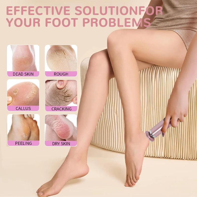 2-in-1 Electric Foot Callus Remover & Pedicure Tool – Rechargeable Dead Skin & Heel Grinder, Professional Foot Care File for Smooth, Soft Feet
