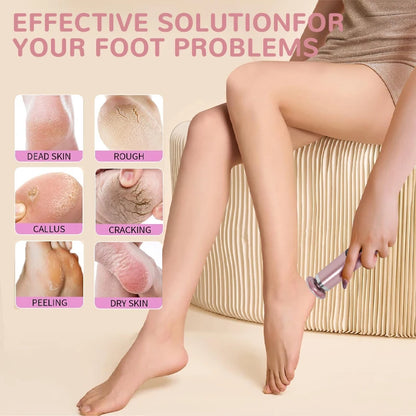 2-in-1 Electric Foot Callus Remover & Pedicure Tool – Rechargeable Dead Skin & Heel Grinder, Professional Foot Care File for Smooth, Soft Feet